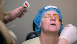 Patient being prepped for LASIK Surgery