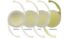 Lens Implant Option Chart