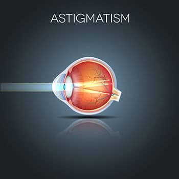 Diagram showing example of Astigmatism